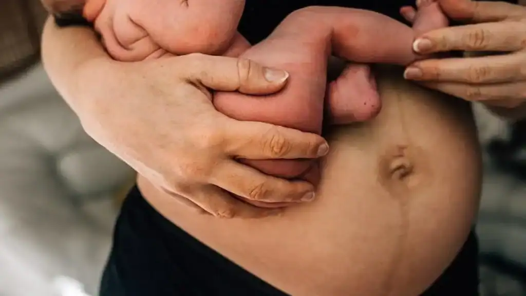 Why Is My Stomach Still Big After Pregnancy Gorgie?